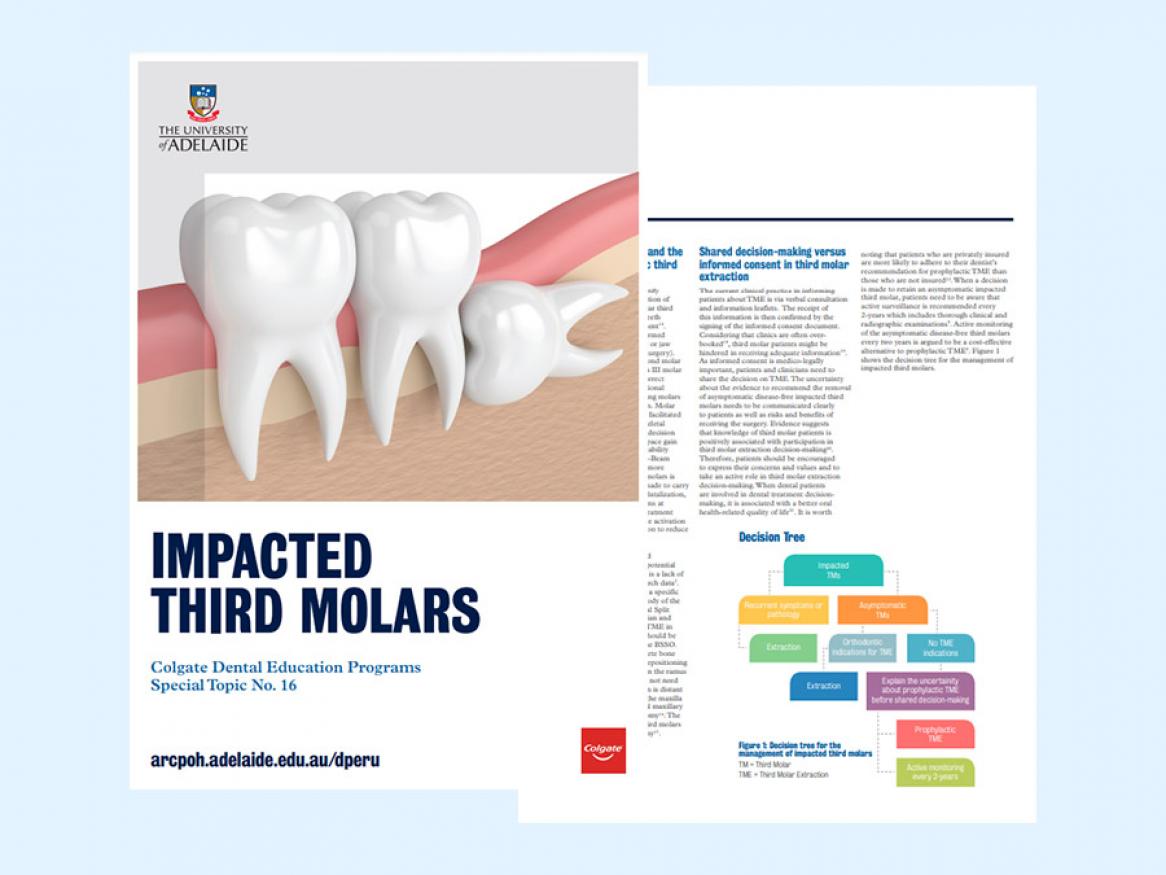 View the practice information sheet on impacted third molars