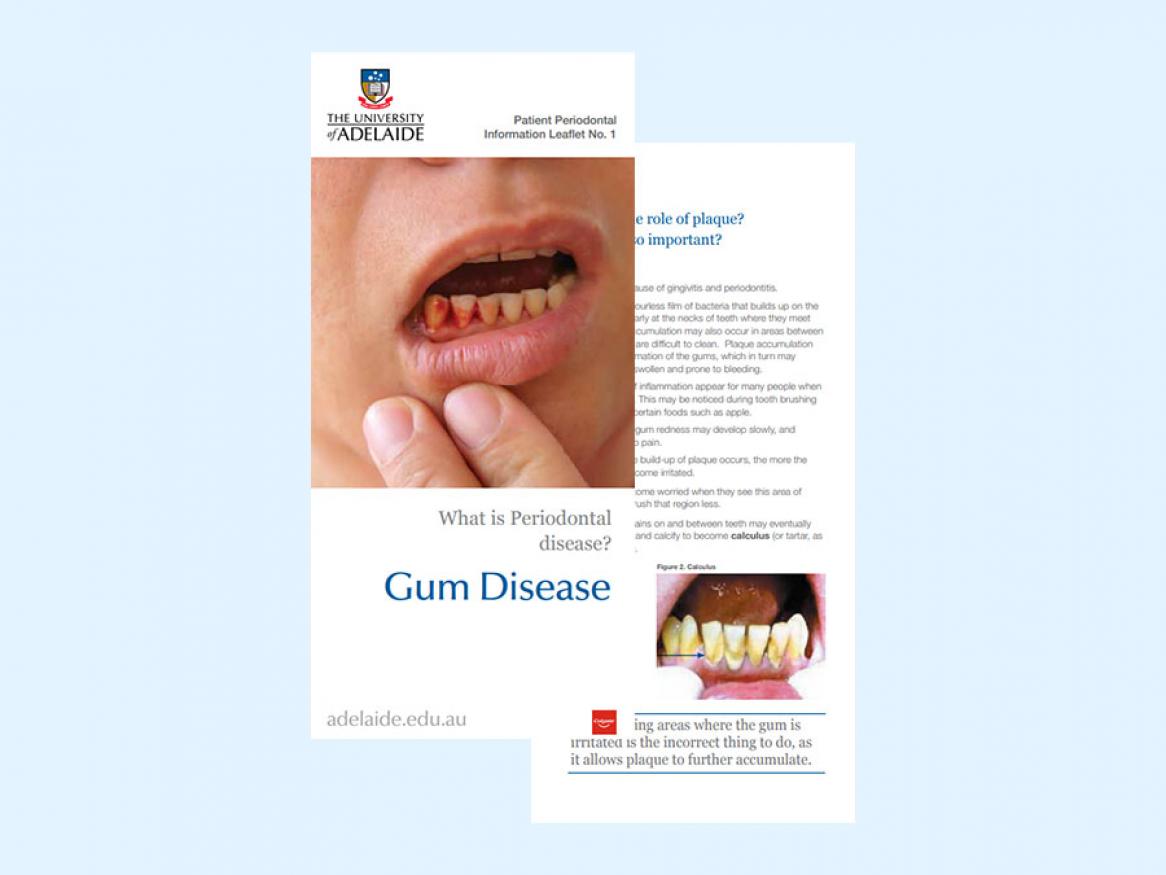 View the pamphlet - What is periodontal disease?