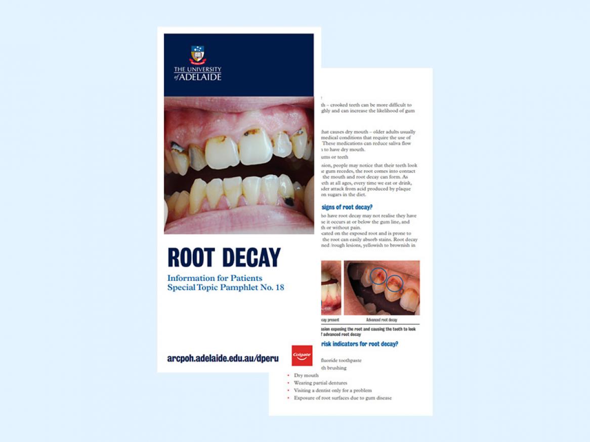 View the patient pamphlet on root decay