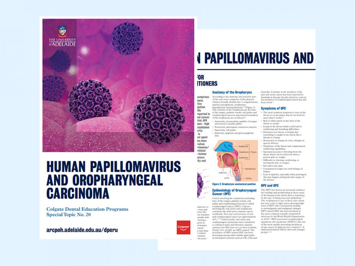 View the practice information sheet on human papillomavirus and oropharyngeal carcinoma
