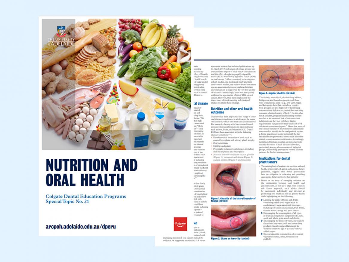 Nutrition And Oral Health | Dental Practice Education Research Unit ...