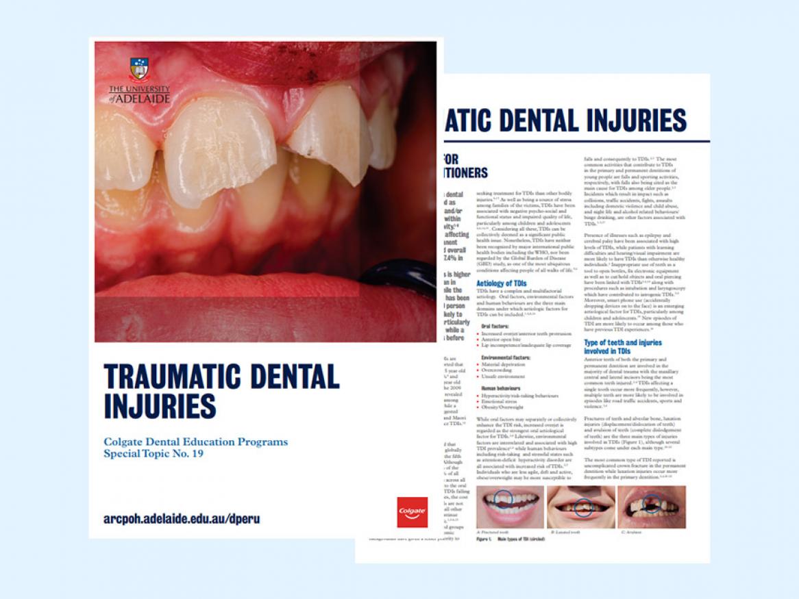View the practice information sheet on traumatic dental injuries