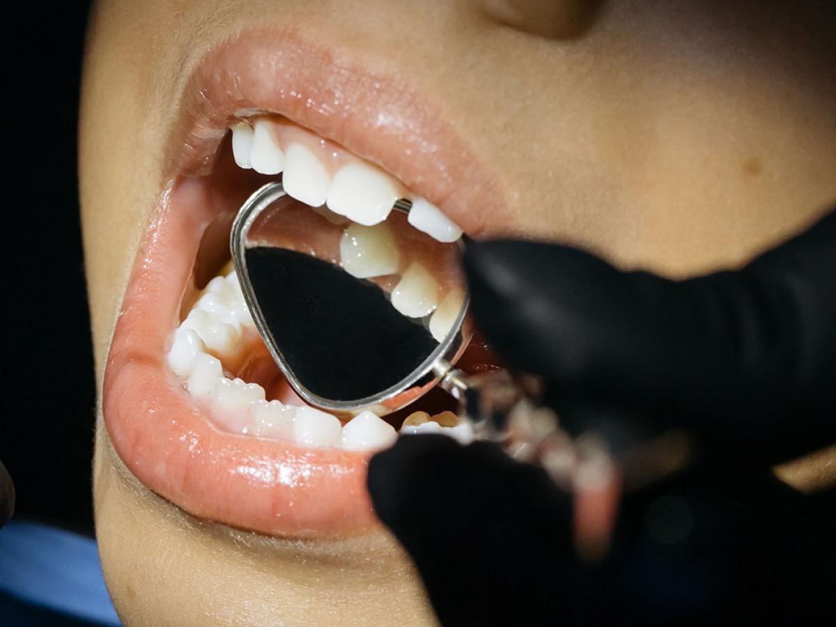 Child having mouth examination at dentist