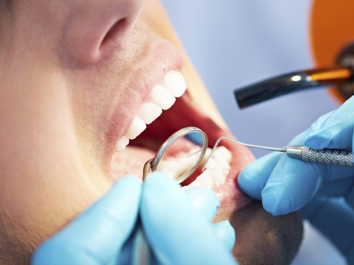 Close up of a dentist examining a patient's mouth