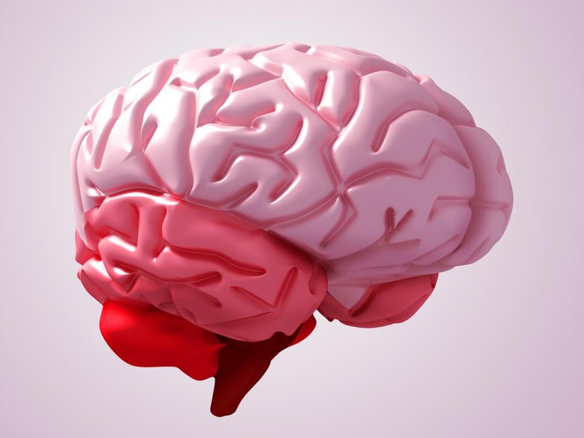 A model of a brain