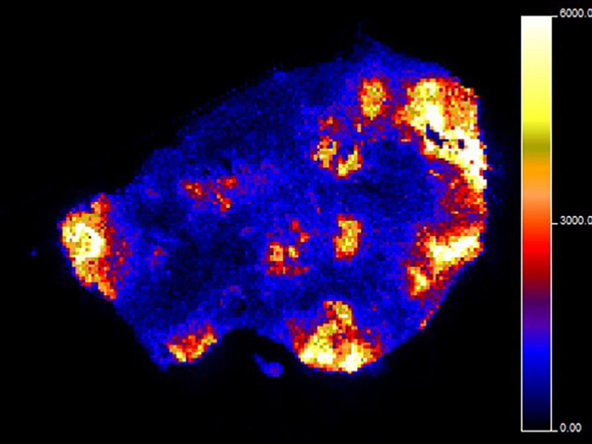 Australian Cancer Research Foundation Funding for the Centre for Integrated Cancer Systems Biology